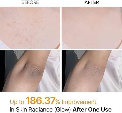 Glass Skin Renewal Kit (6 pcs) ™