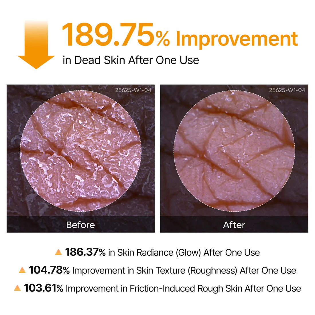 Glass Skin Renewal Kit (6 pcs) ™