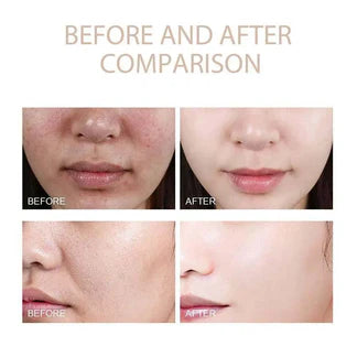 Dr. Melaxin Glow RiceGlass Skin Premium Kit (6 pcs)™