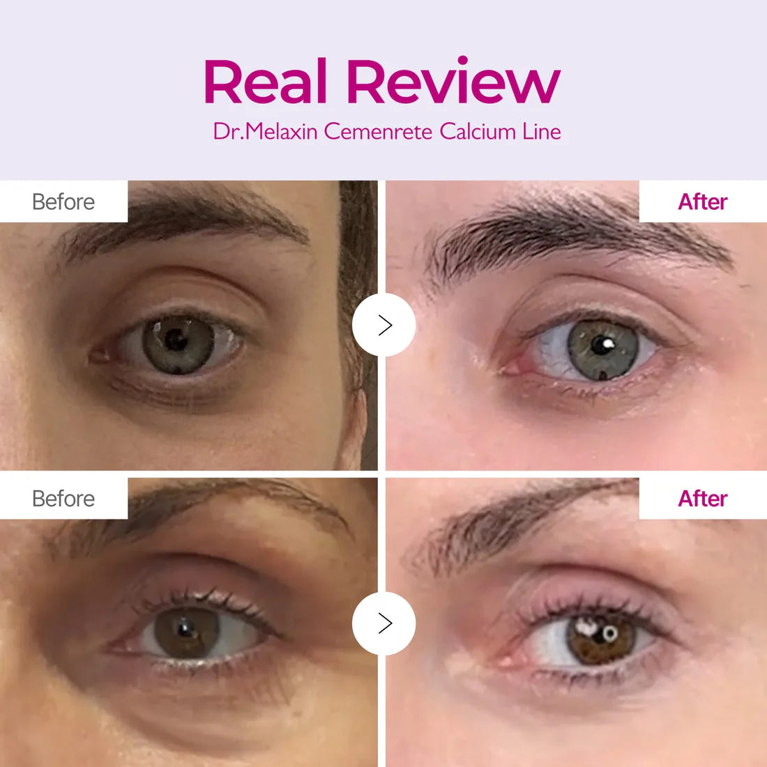 Dr Melaxin Collagen Boost Set – before and after