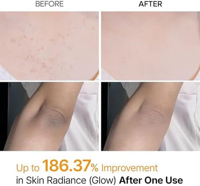 Glass Skin Renewal Kit (6 pcs) ™