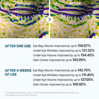 Eyephalt Eyebag Cream