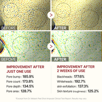 Peel Shot Glow White Rice Ampoule