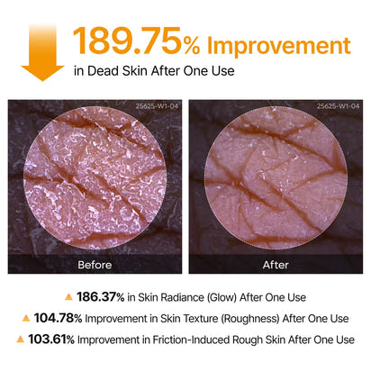 Glass Skin Renewal Kit (6 pcs) ™