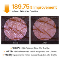 Glass Skin Renewal Kit (6 pcs) ™