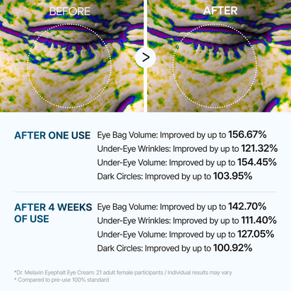 [SPECIAL 1+1 DEAL] Eyephalt eyebag cream