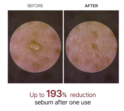 Dr. Melaxin Glow RiceGlass Skin Premium Kit (6 pcs)™